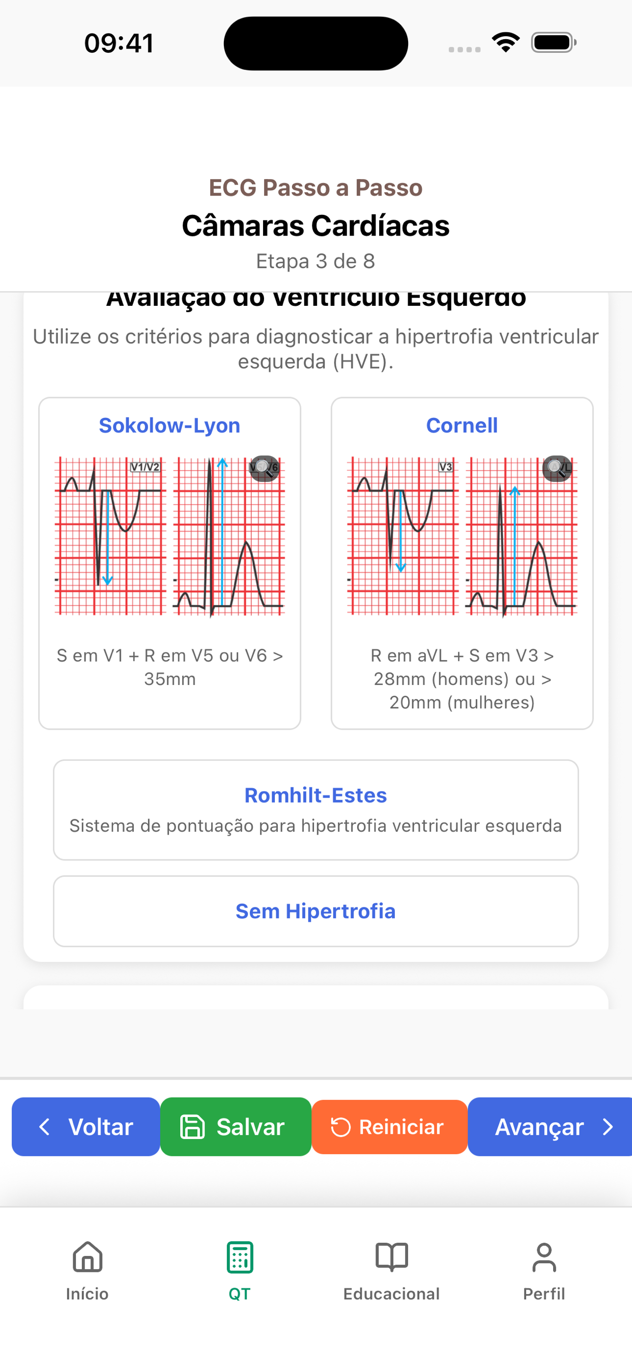 Avaliação de câmaras